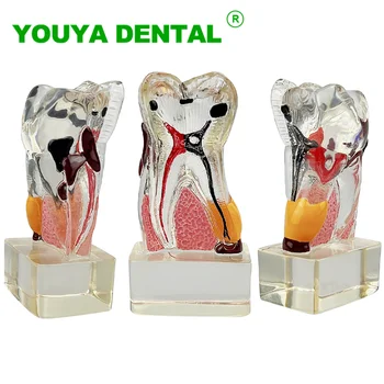 Dantų Anatomija Dantų Modelio Mokymo Studijų Skaidrus Molinis Periodonto Ligos Modelį, Odontologija, Stomatologas Demonstravimo Modelis